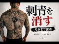 刺青を消す。Vol.1|なぜ消すのか、刺青について語る