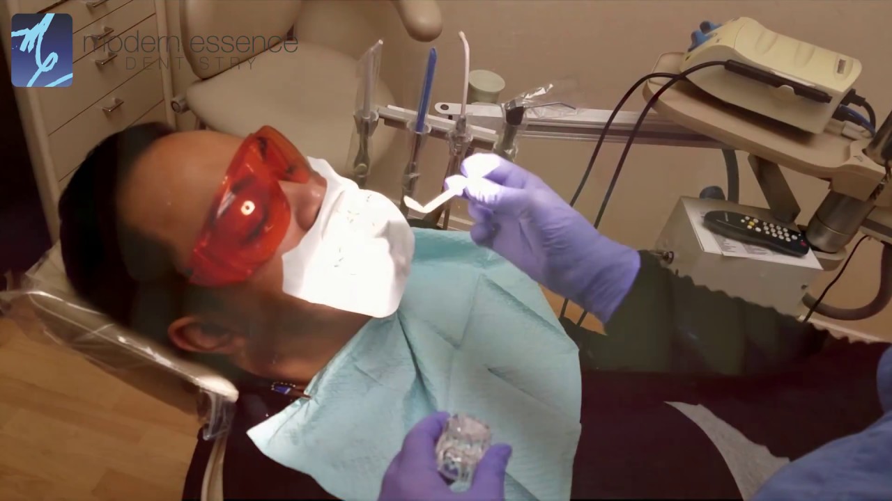 Zoom Whitening Testimonial Before and After Photos YouTube