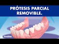 Prótesis parcial removible - ¿Cómo funcionan? ©