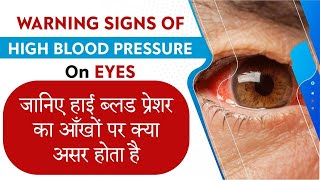 Know how high blood pressure damages your eyesight