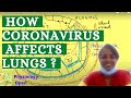 Coronavirus pathophysiology | Pneumonia caused by coronavirus