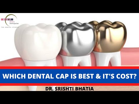 Types of teeth caps, What's Best & it's Cost? जानिए कौनसा टूथ कैप