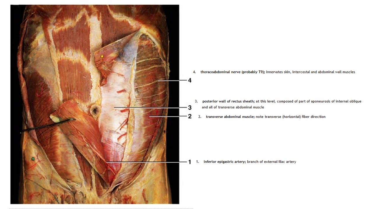 İnguinal herni onarımı nasıl yapılır?