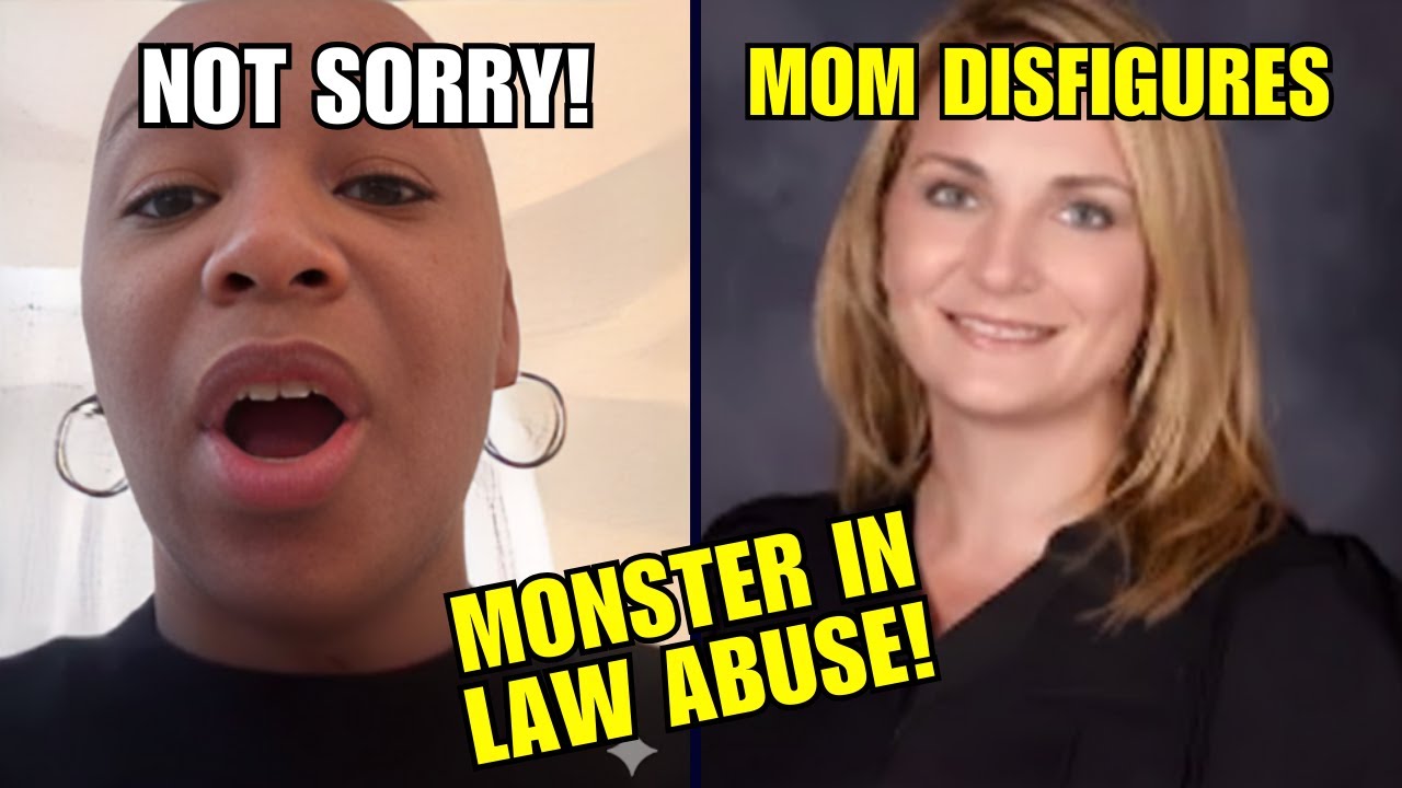 Unlicensed Mom Disfigures Child, Refuses to Take Responsibility