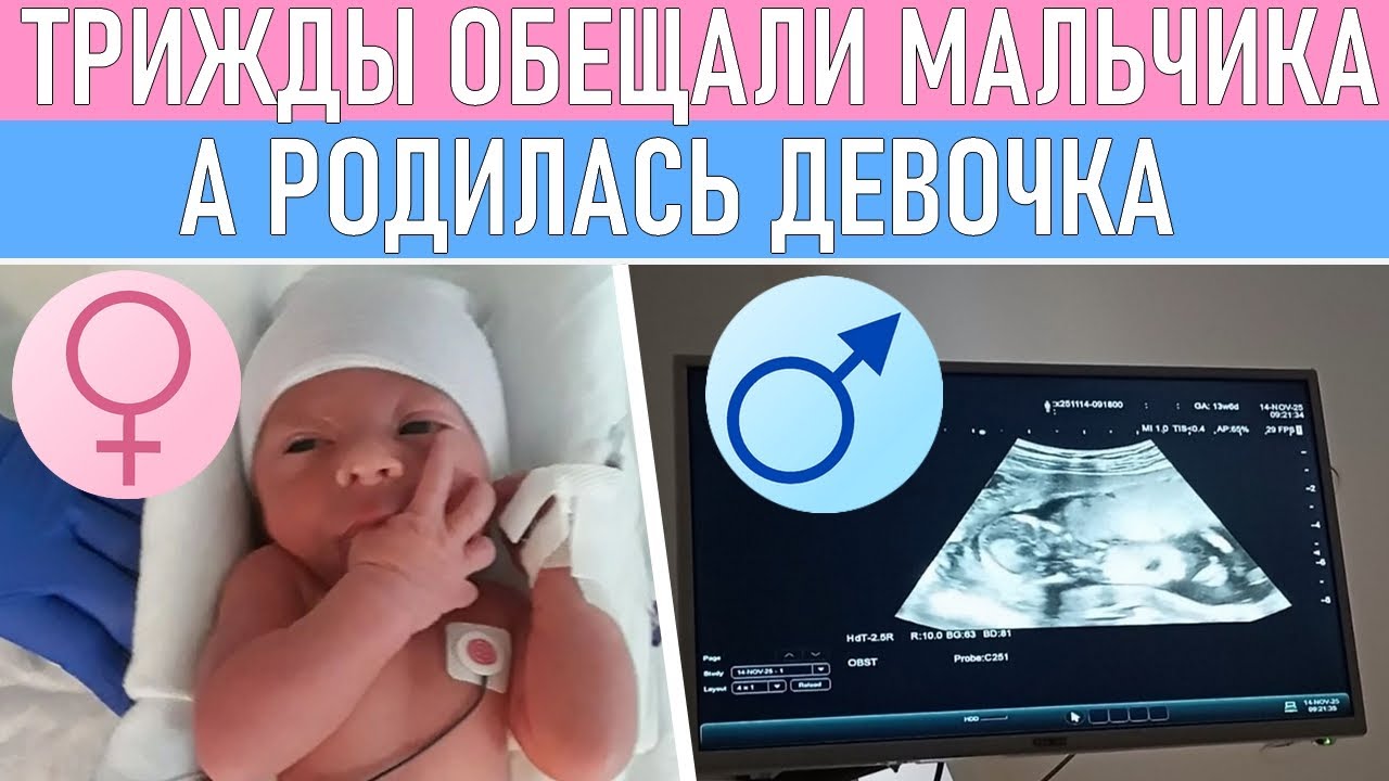 ПО УЗИ МАЛЬЧИК А РОДИЛАСЬ ДЕВОЧКА | Как ошибается УЗИ | Пол ребенка по УЗИ
