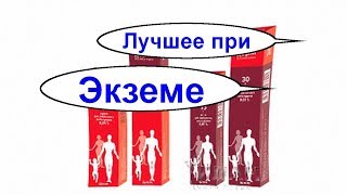 Лечение экземы на руках и ногах. Как вылечить экзему. Копеечная мазь и сильнейшее средство за 1$ Лечение экземы на руках и ногах. Как вылечить экзему. Копеечная мазь и сильнейшее средство за 1$