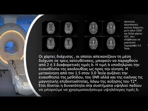 ΑΠΕΙΚΟΝΙΣΗ ΣΕ ΜΑΓΝΗΤΙΚΟΥΣ ΤΟΜΟΓΡΑΦΟΥΣ ΥΨΗΛΟΥ ΠΕΔΙΟΥ: ΠΛΕΟΝΕΚΤΗΜΑΤΑ ΚΑΙ ΠΕΡΙΟΡΙΣΜΟΙ