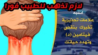 أهم ١٠ أعراض وعلامات نقص فيتامين (د) Vitamin (D) defeciency Symptoms