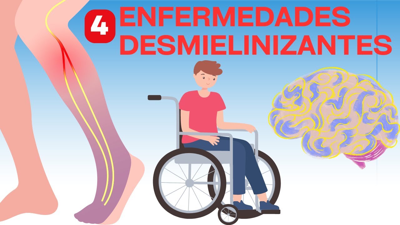 Las 4 enfermedades desmielinizantes más importantes