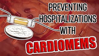 Avoiding Hospitalization and Monitoring Heart Failure with CardioMEMS by Dr. Pradip Jamnadas, MD 28,837 views 3 years ago 10 minutes, 12 seconds