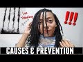 Got THINNING Locs? THIS Might Be What You Are Doing Wrong. | Healthy Loc Growth