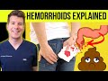 Doctor explains HEMORRHOIDS  (aka piles) | Causes, symptoms, treatment & prevention