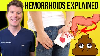 Doctor explains HEMORRHOIDS  (aka piles) | Causes, symptoms, treatment \& prevention