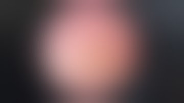 Sỏi niệu quản, nên làm gì? TTƯT.TS.BS.Dương Văn Trung ☎️0913534343.website:soithan.net.vn