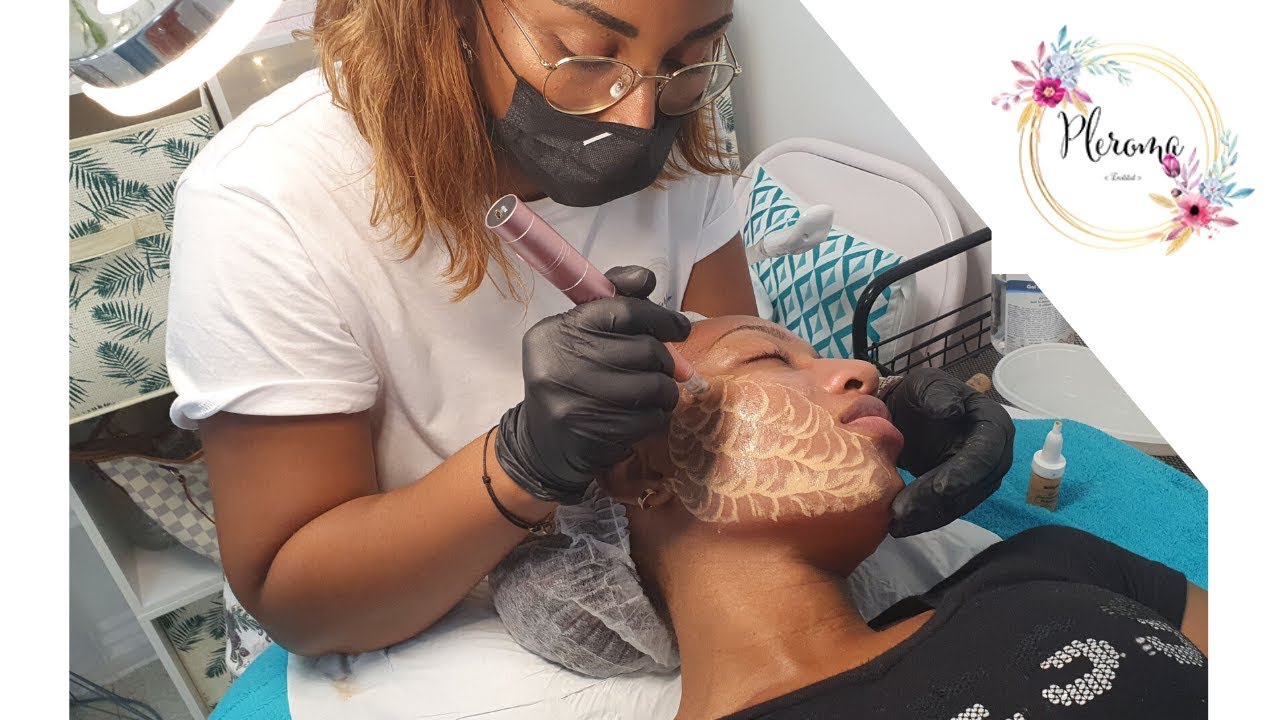 J'ai testé le MICRONEEDLING / BB GLOW en Guadeloupe !