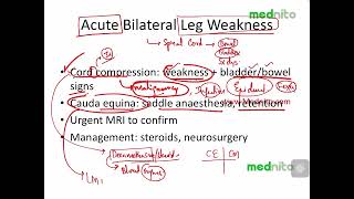 PLAB 1 2025 Neurology 3