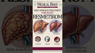 THYROID HORMONE DRUG FOR FATTY LIVER DISEASE?