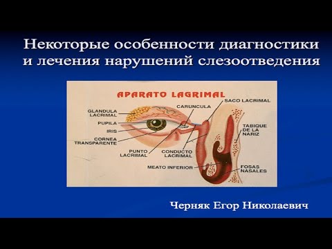 Некоторые особенности диагностики и лечения нарушений слезоотведения