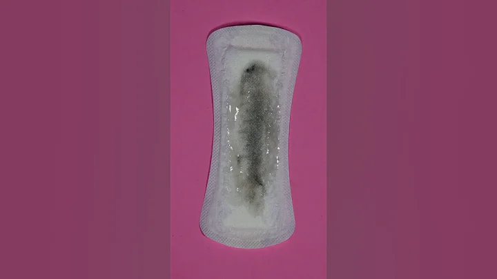 Why Is My Discharge Grey? Could It Be Bacterial Vaginosis (BV)?