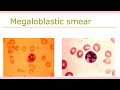 Hematology review part-3 | Introduction to hematology | function of blood physiology |#mbbs #dmlt
