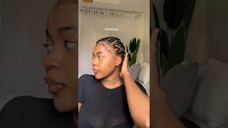 Bald braids hairstyles #cornrows