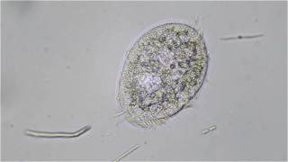 Unknown Small Ciliate
