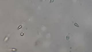 semen under microscope