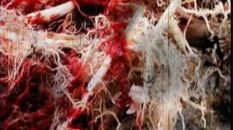Experiments in psychosis - High Resolution 720p x 480p version - Pneumatic Detach Experiments in psychosis - High Resolution 720p x 480p version - Pneumatic Detach