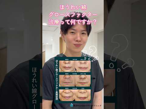 ほうれい線グロースファクターとは！？　#美容整形 #美容皮膚科 #ほうれい線 #シワ改善 #グロースファクター #若返り #東京Houreisen