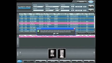 DICOM Send - Clarity WorkFlow Series