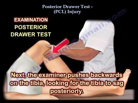 Posterior Drawer Test,  PCL Injury - Everything You Need To Know - Dr. Nabil Ebraheim