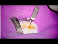 Root Canal Glide Path Help - 6,8,10 sequence - The Calcified Tooth Series