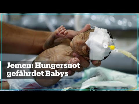 Video: Eltern Verhungern Baby