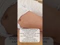 Шрам вызывал Сколиоз Нет Отсекатель нужно знать в ММТ Sjdtr квантоваякоррекция ммт мастерхруст Шрам вызывал Сколиоз Нет Отсекатель нужно знать в ММТ Sjdtr квантоваякоррекция ммт мастерхруст