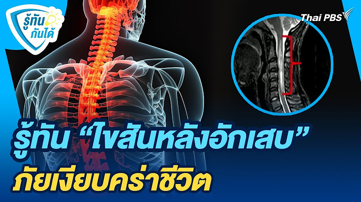 รู้ทัน "ไขสันหลังอักเสบ" ภัยเงียบคร่าชีวิต | รู้ทันกันได้ | วันใหม่วาไรตี้