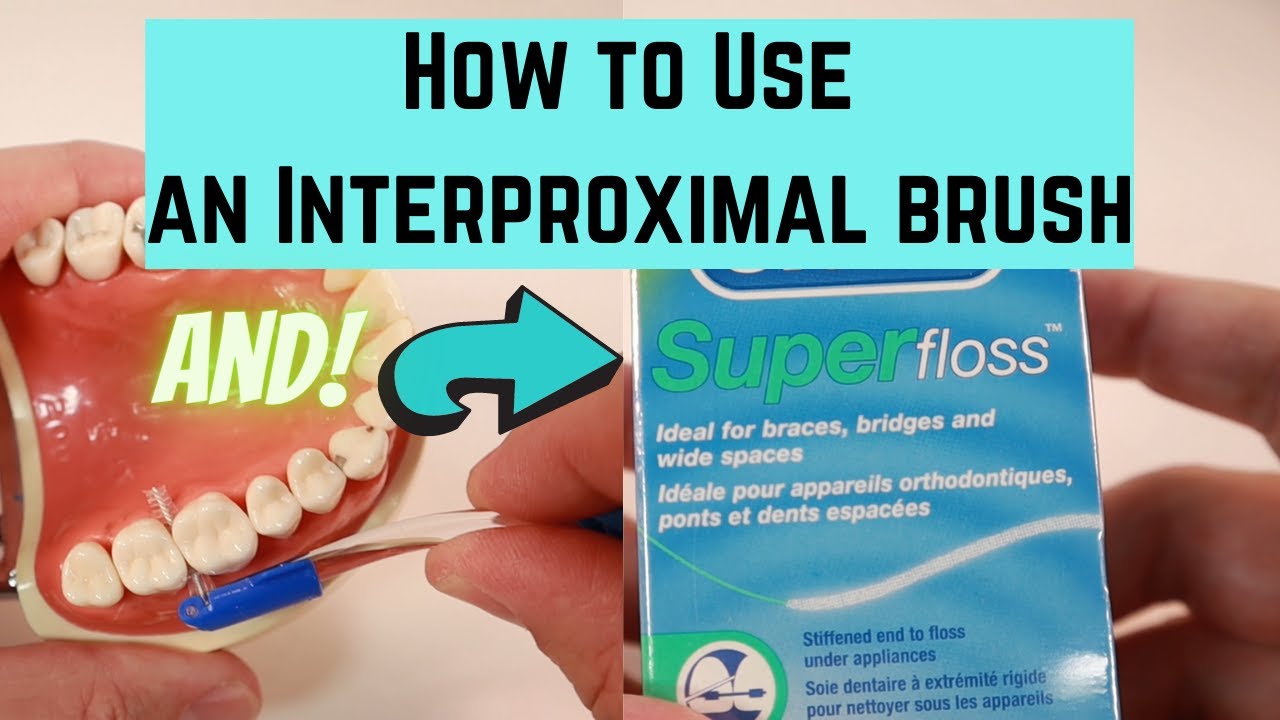 How to use an interproximal brush and superfloss. 