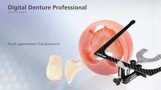 Digital Denture – fourth Appointment