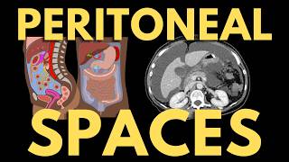 Peritoneal Spaces Explained (How Fluid Spreads on CT) | Radiology Anatomy