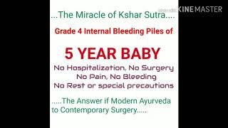 Kshar sutra treatment of grade 4 piles of 5year old baby