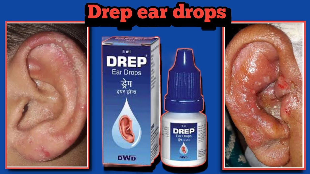 DREP ear drop review in Hindi Best medicine For ear infection/DwD PHARMA YouTube