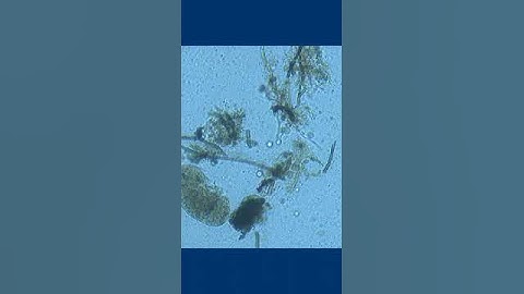 Black mold in a refrigerator! #microscopy #shorts #health