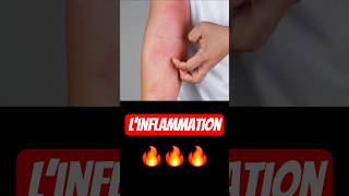 Inflammation Savoir La Reconnaître. É