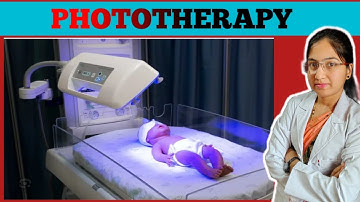Phototherapy | Phototherapy for Babies | Neonatal Jaundice Treatment | Phototherapy Procedure