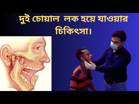 ভিডিও: কিভাবে টেটানোস্পাসমিন রোগ সৃষ্টি করে?