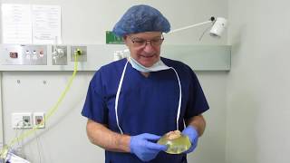 Breast Implant Removal - Dr Allan Kalus