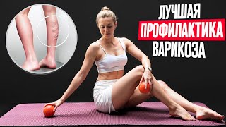 Всё про варикоз и геморрой! Что можно и что нельзя делать? Как улучшить состояние вен?