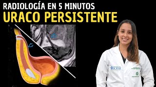 Radiología en 5 minutos: Uraco persistente.