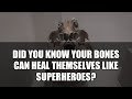 5 Amazing Facts About Bone Healing #shorts