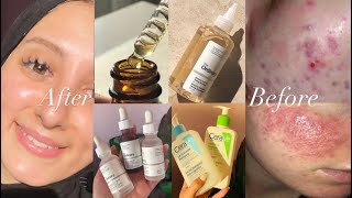 ✨how did l treat my skin?!🙊كيفاش عالجت +Big skin care routine 🫧🪒💧 بشرتي 🫶✨