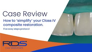 How to simplify your Class IV composite restorations